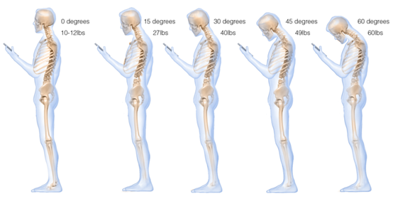 اثرات منفی استفاده از موبایل برای وبگردی روی گردن
